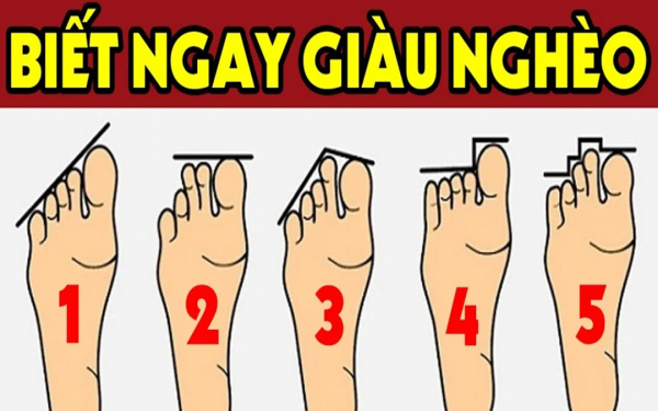 Người giàu có trên bàn chân có dấu hiệu này: Ai sở hữu không thành tỷ phú cũng thành đại gia